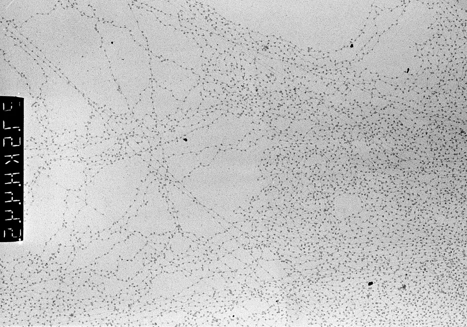 Fibras de cromatina vistas al microscopio electrónico: hilos de ADN con nucleosomas como cuentas de un collar