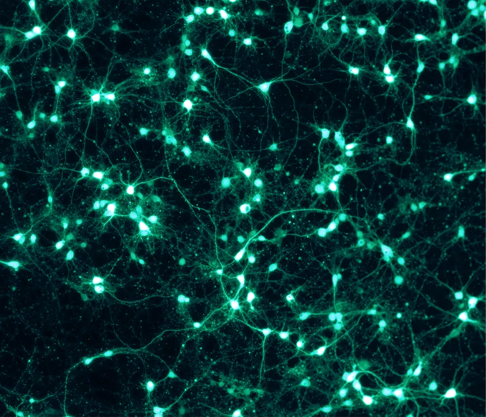 Cultivo de neuronas marcadas con proteína verde fluorescente: cuerpos celulares brillantes unidos por prolongaciones finas sobre fondo negro