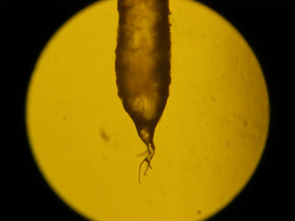 Raíz de un pelo humano arrancado, vista al microscopio óptico