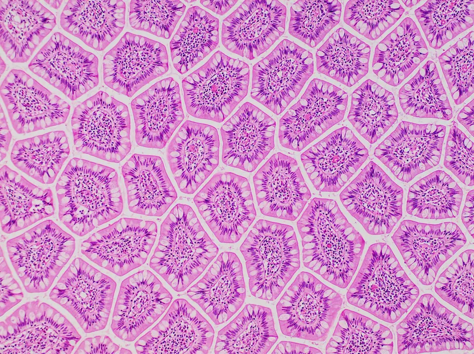 Corte al microscopio de vellosidades del intestino delgado, teñidas de rosa y violeta